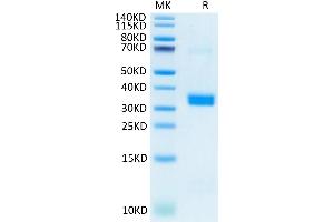 Human APOE on Tris-Bis PAGE under reduced condition.