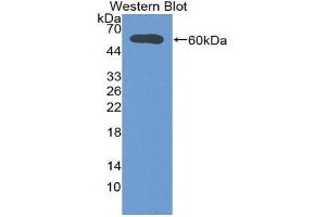 Western Blotting (WB) image for anti-Deiodinase, Iodothyronine, Type II (DIO2) (AA 30-259) antibody (ABIN1858636)