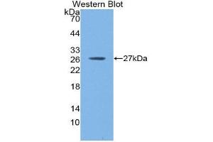 Western Blotting (WB) image for anti-C-Reactive Protein (CRP) (AA 17-224) antibody (ABIN3201506) (CRP anticorps  (AA 17-224))
