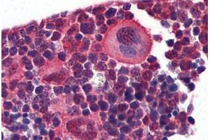 Mouse Lymphoid Tissue: Formalin-Fixed, Paraffin-Embedded (FFPE) (NK2 Homeobox 3 anticorps  (AA 281-330))