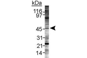 Western blot analysis of Lyve1 in mouse spleen lysate using Lyve1 polyclonal antibody . (LYVE1 anticorps  (AA 250-318))