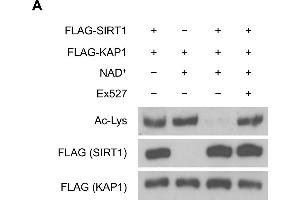 SIRT1 deacetylates KAP1 in vitro and in vivo. (Acetylated Lysine anticorps)