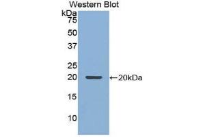Western Blotting (WB) image for anti-Nucleoporin 210kDa (NUP210) (AA 1149-1295) antibody (ABIN1860082)