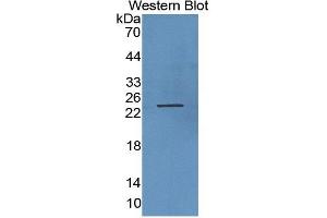 WB of Protein Standard: different control antibodies against Highly purified E. (Growth Hormone 1 Kit CLIA)