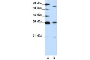 PRDM13 antibody (20R-1222) used at 1. (PRDM13 anticorps  (C-Term))