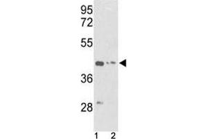 Western blot analysis of g-Actin antibody and (1) K562 and (2) HepG2 lysate (Actin, gamma 1 anticorps  (AA 188-215))