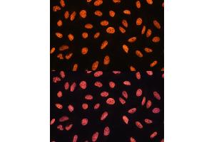 Immunofluorescence analysis of U20S cells using CHD4 antibody (ABIN6127308, ABIN6138512, ABIN6138513 and ABIN6215263) at dilution of 1:100.
