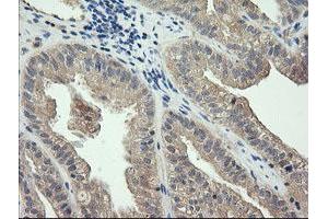 Image no. 2 for anti-Cancer/testis Antigen 1B (CTAG1B) antibody (ABIN1499892)