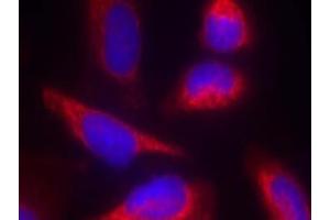 Image no. 1 for anti-Nitric Oxide Synthase 3 (Endothelial Cell) (NOS3) (Thr863) antibody (ABIN401626) (ENOS anticorps  (Thr863))