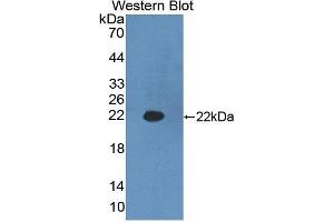 Detection of Recombinant HADH, Mouse using Polyclonal Antibody to Hydroxyacyl Coenzyme A Dehydrogenase (HADH) (HADH anticorps  (AA 1-167))