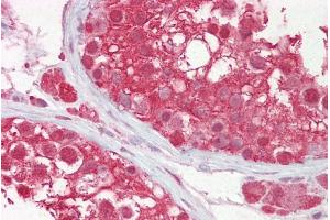 Immunohistochemistry with Testis tissue at an antibody concentration of 10µg/ml using anti-CUL3 antibody (ARP61264_P050)