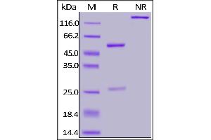 Anti-SARS-CoV-2 Nucleocapsid Antibody, Human IgG1 on SDS-PAGE under reducing (R) condition.