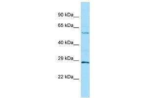 WB Suggested Anti-MINPP1 Antibody Titration: 1. (MINPP1 anticorps  (C-Term))