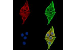ABIN7097106 and ABIN7101173 staining Hela cells by IF/ICC. (OSCAR anticorps)
