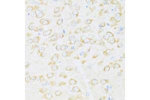 anti-DEAD (Asp-Glu-Ala-Asp) Box Polypeptide 3, Y-Linked (DDX3Y) (AA 1-210) antibody