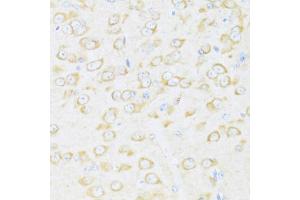 Immunohistochemistry of paraffin-embedded mouse brain using DDX3Y antibody (ABIN6130260, ABIN6139496, ABIN6139497 and ABIN6215395) at dilution of 1:100 (40x lens). (DDX3Y anticorps  (AA 1-210))