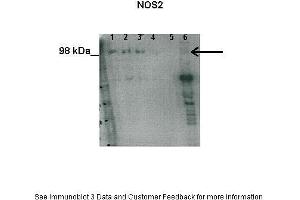 Researcher: Hiten Mistry, Ania Czajka and Marta Hentschke Ribeiro, King's College LondonApplication: Western blottingSpecies+tissue/cell type: Human placental and myometrial tissue lysate  How many ug'sof tissue/cell lysate run on the gel: 1:50 µg human placental tissue lysate2: 00 µg human placental tissue lysate3: 00 µg human placental tissue lysate4: 00 µg human placental tissue lysate5: 10 µg human placental tissue lysate6: 00 µg human myometrial tissue lysate Primary Antibody dilution: 1:000Secondary Antibody: Goat anti-rabbit HRP Secondary Antibody Dilution: 1:00000