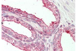 anti-Tetraspanin 1 (TSPAN1) (Middle Region) antibody