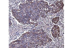 IHC analysis of EGFR using anti-EGFR antibody (ABIN7599622). (EGFR anticorps  (AA 1006-1210))