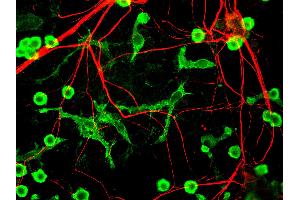 Mixed neuron glia cultures stain with INA antibody (red) and counterstained with rabbit polyclonal antibody to Coronin 1a, (green) which is an excellent marker of microglia and lymphocytes. (INA anticorps)
