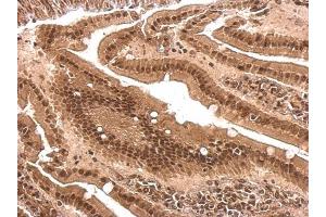 IHC-P Image PCBP2 antibody [N1C1] detects PCBP2 protein at nucleus and cytosol on mouse intestine by immunohistochemical analysis.