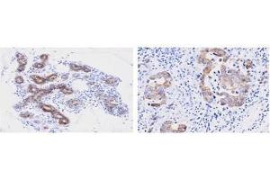 Immunohistochemistry (IHC) image for anti-Peptidylprolyl Isomerase F (PPIF) (AA 30-207) antibody (ABIN356236)