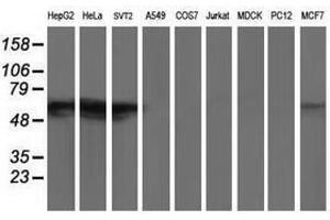 Image no. 2 for anti-Glucosidase, Beta, Acid 3 (Cytosolic) (GBA3) (AA 1-150), (AA 370-469) antibody (ABIN1490586)