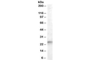 Western blot testing of human adrenal gland lysate with IGFBP6 antibody at 0. (IGFBP6 anticorps)