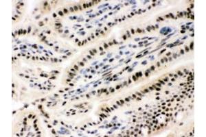 IHC testing of frozen mouse small intestine tissue with RBBP4 antibody. (RBBP4 / RbAp48 / NURF55 anticorps)