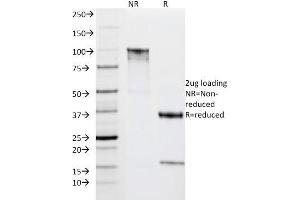 SDS-PAGE Analysis Purified HLA-DRA Mouse Monoclonal Antibody (IPO-10). (HLA-DRA anticorps)