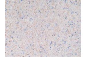 IHC-P analysis of Human Brain Tissue, with DAB staining. (MBP anticorps  (AA 135-190))