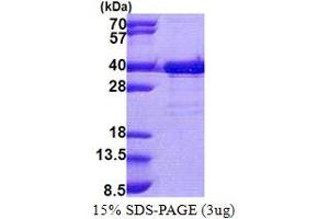 SDS-PAGE (SDS) image for Tetratricopeptide Repeat Domain 35 (TTC35) (AA 1-297) protein (His tag) (ABIN5853112)