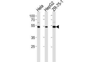 Western Blotting (WB) image for anti-Telomeric Repeat Binding Factor 2, Interacting Protein (TERF2IP) antibody (ABIN2997696) (RAP1 anticorps)