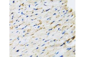 Immunohistochemistry of paraffin-embedded Rat heart using RAF1 Polyclonal Antibody at dilution of 1:100 (40x lens).