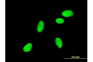 Immunofluorescence of monoclonal antibody to NEUROG2 on HeLa cell. (Neurogenin 2 anticorps  (AA 36-112))