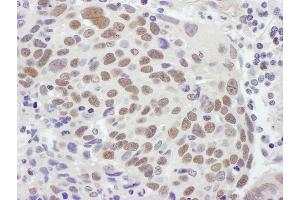 Immunohistochemistry (IHC) image for anti-Mismatch Repair Protein 2 (MSH2) (C-Term) antibody (ABIN7453440) (MSH2 anticorps  (C-Term))