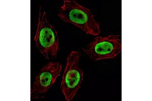 Fluorescent image of  cell stained with EZH2 Antibody (ABIN659002 and ABIN2838040) / SG100830. (EZH2 anticorps)