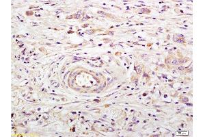 Immunohistochemistry (Paraffin-embedded Sections) (IHC (p)) image for anti-Angiotensin I Converting Enzyme 2 (ACE2) (AA 601-700) antibody (ABIN730798)