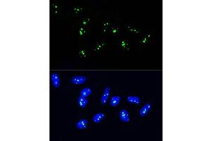 Immunofluorescence analysis of U2OS cells using NOP58 Rabbit pAb (ABIN1681073, ABIN3019190, ABIN3019191 and ABIN6220753) at dilution of 1:100.
