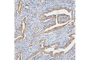 IHC analysis of CETP using anti-CETP antibody (ABIN7602439).