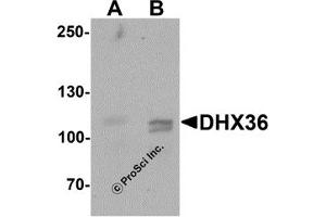 Western Blotting (WB) image for anti-DEAH (Asp-Glu-Ala-His) Box Polypeptide 36 (DHX36) (C-Term) antibody (ABIN1077418) (DHX36 anticorps  (C-Term))