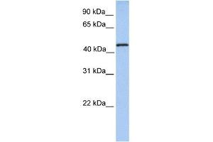 TRMT11 antibody used at 1 ug/ml to detect target protein. (Trmt11 anticorps)
