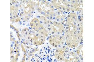 Immunohistochemistry of paraffin-embedded Mouse kidney using BSND Polyclonal Antibody at dilution of 1:100 (40x lens). (BSND anticorps)