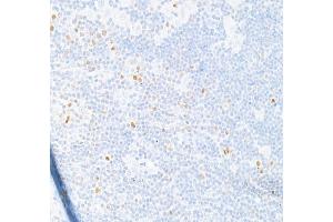 Immunohistochemistry (IHC) image for anti-T-Bet (AA 485-535) antibody (ABIN7455151)