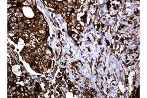 Image no. 13 for anti-Pogo Transposable Element with KRAB Domain (POGK) antibody (ABIN1500329)