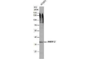 WB Image NHERF-2 antibody detects NHERF-2 protein by western blot analysis. (SLC9A3R2 anticorps  (Center))