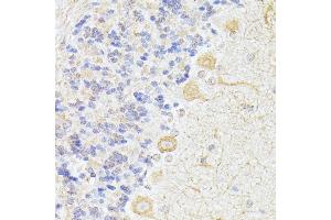 Immunohistochemistry of paraffin-embedded rat cerebellum using K/K/Elp3 antibody (ABIN6130883, ABIN6140142, ABIN6140143 and ABIN6225217) at dilution of 1:100 (40x lens). (ELP3/KAT9 anticorps  (AA 358-547))