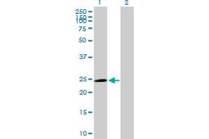 Western Blot analysis of TRIM50C expression in transfected 293T cell line by TRIM50C MaxPab polyclonal antibody. (TRIM74 anticorps  (AA 1-249))