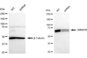 Western blotting analysis using HNRNPM antibody (ABIN7798901). (Recombinant HNRNPM anticorps)