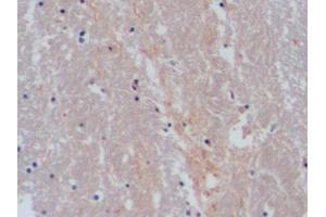 Detection of SERT in Human Cerebrum Tissue using Polyclonal Antibody to Serotonin Transporter (SERT)